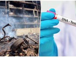 कैसे होता है DNA टेस्ट, अहमदाबाद विमान हादसे में मारे गए लोगों की बताएगा पहचान कैसे होता है DNA टेस्ट, अहमदाबाद विमान हादसे में मारे गए लोगों की बताएगा पहचान