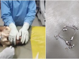 Rajasthan: अजमेर में 2 साल की बच्ची ने निगल ली पायल, डॉक्टरों ने एंडोस्कोपी से बचाई जान Rajasthan: अजमेर में 2 साल की बच्ची ने निगल ली पायल, डॉक्टरों ने एंडोस्कोपी से बचाई जान