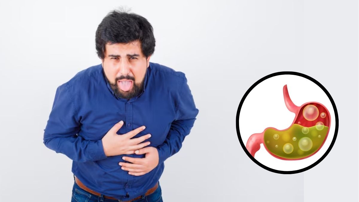 Acidity Home Remedies: एसिडिटी की समस्या का रामबाण उपाय हैं ये किचन में मौजूद ये 4 मसाले