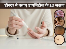 डॉक्टर ने कहा Diabetes होने से पहले शरीर में दिखने लगते हैं ये 10 लक्षण, डायबिटीज की पहचान के बाद बदल दें ये चीजें डॉक्टर ने कहा Diabetes होने से पहले शरीर में दिखने लगते हैं ये 10 लक्षण, डायबिटीज की पहचान के बाद बदल दें ये चीजें