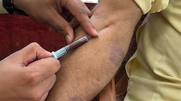 Blood For Sale: NDTV's Operation Blood Exposes Black Market Outside Hospitals