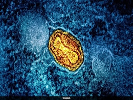 Hundreds Of New Giant Viruses Discovered In Global Waters: Study Hundreds Of New Giant Viruses Discovered In Global Waters: Study