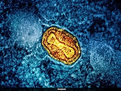 Tackling This Childhood Virus Early May Reduce Bladder Cancer Risks Later: Study