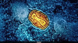 Tackling This Childhood Virus Early May Reduce Bladder Cancer Risks Later: Study