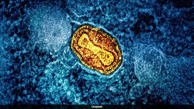 Tackling This Childhood Virus Early May Reduce Bladder Cancer Risks Later: Study