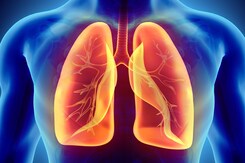 फेफड़ों का कैंसर कितने तरह का होता है? लंग कैंसर के प्रकार
