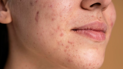 glutathione supplement in bangladesh Benefits Of Glutathione And Collagen main image 1