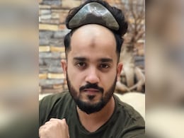 पुरुषों और महिलाओं में बढ़ते गंजेपन के कारण दिल्ली-एनसीआर में करोड़ों की हुई हेयर पैच इंडस्ट्री पुरुषों और महिलाओं में बढ़ते गंजेपन के कारण दिल्ली-एनसीआर में करोड़ों की हुई हेयर पैच इंडस्ट्री