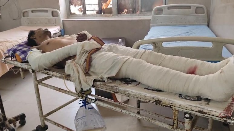बूंदी: जमीन विवाद के लिए पुजारी पर बर्बरता से हमला, हाथ-पैर तोड़े; हालत गंभीर
