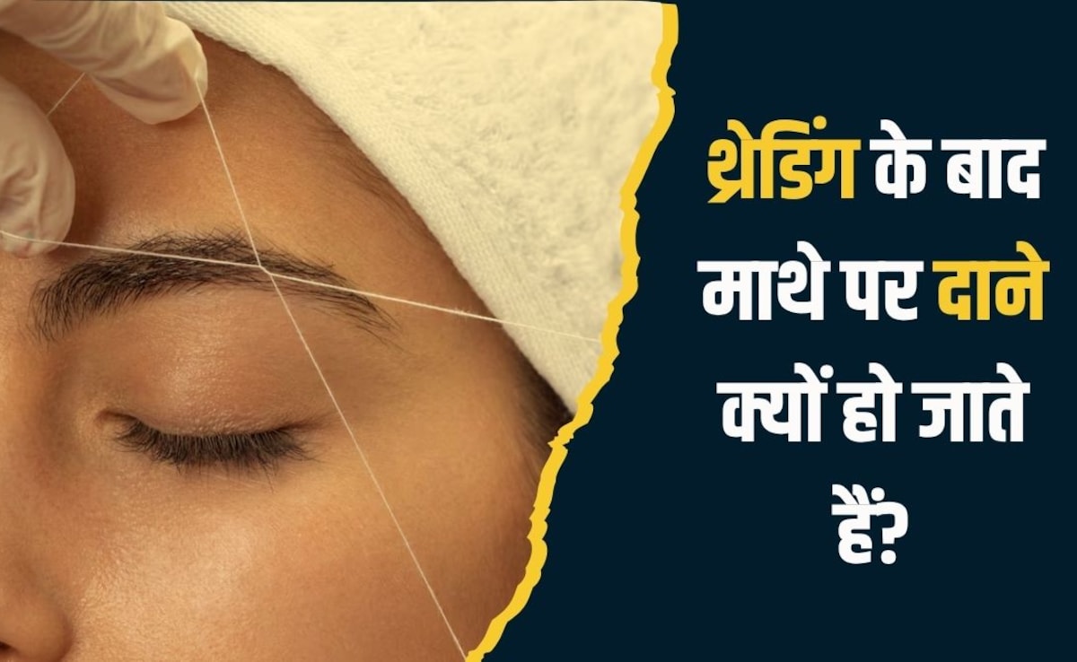 थ्रेडिंग करने का बाद माथे पर दाने क्यों हो जाते हैं? डर्माटॉलॉजिस्ट से ...