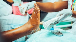Fungus, Cuts, HIV: That Pedicure Comes With Risks No One Tells You About