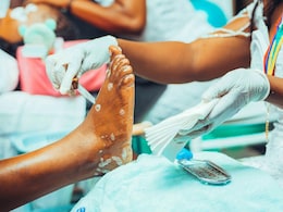 Fungus, Cuts, HIV: That Pedicure Comes With Risks No One Tells You About Fungus, Cuts, HIV: That Pedicure Comes With Risks No One Tells You About