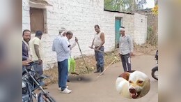 Dog Bite: डॉग बाइट के एक दिन में 30 से ज्यादा मामले, जिला अस्पताल में कम पड़ रहे&nbsp;रेबीज के इंजेक्शन!&nbsp;