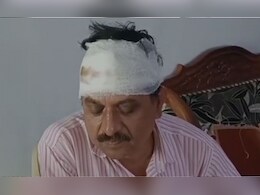 घर में घुस बदमाशों ने इनकम टैक्स ऑफिसर पर पत्थर से किया हमला, पत्नी के साथ भी धक्का-मुक्की कर भागे