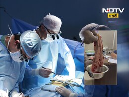 Shocking News: सिझेरियन करताना डॉक्टरांचा निष्काळजीपणा! महिलेच्या पोटात दुखू लागलं, सोनोग्राफीत जे समोर आलं ते..