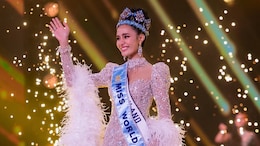 NDTV Exclusive: Miss World 2025 Opal Suchata Says, "I Had Breast Surgery For A Tumour At 16"