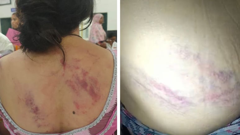 छोटी बात पर छात्राओं में झगड़ा, परिजनों ने बाल पकड़ चेहरा जमीन पर पटका, बोले, अब हमारे सामने नाक रगड़ो