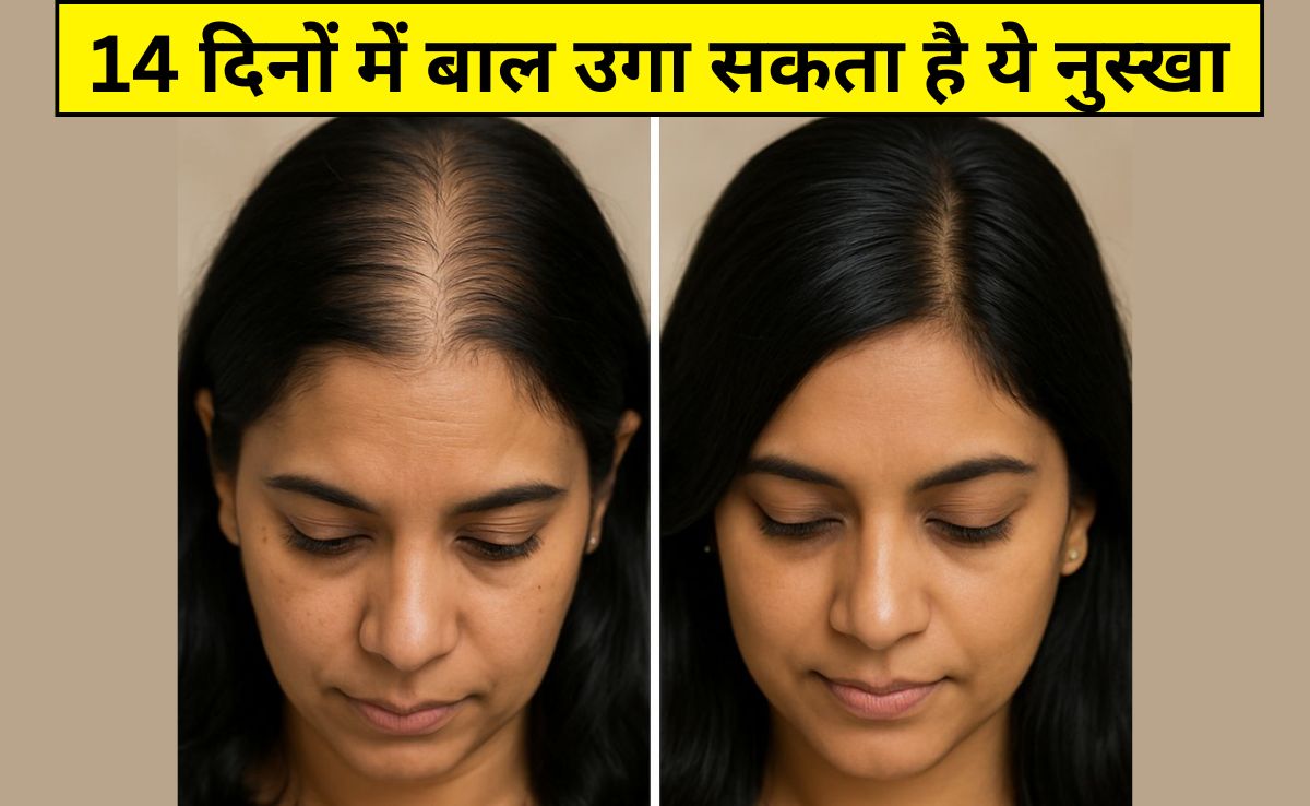 35 की उम्र के बाद तेजी से गिर रहे हैं बाल और दिखने लगी है स्कैल्प? आयुर्वेदिक डॉक्टर ने कहा- 4 काम कर लें, 14 दिनों में दिखेगा फर्क