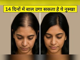 35 की उम्र के बाद तेजी से गिर रहे हैं बाल और दिखने लगी है स्कैल्प? आयुर्वेदिक डॉक्टर ने कहा- 4 काम कर लें, 14 35 की उम्र के बाद तेजी से गिर रहे हैं बाल और दिखने लगी है स्कैल्प? आयुर्वेदिक डॉक्टर ने कहा- 4 काम कर लें, 14