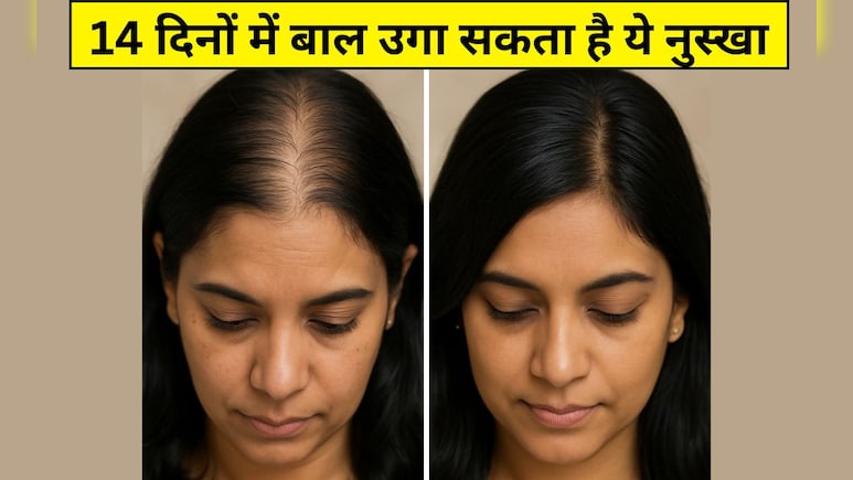 35 की उम्र के बाद तेजी से गिर रहे हैं बाल और दिखने लगी है स्कैल्प? आयुर्वेदिक डॉक्टर ने कहा- 4 काम कर लें, 14 दिनों में दिखेगा फर्क 35 की उम्र के बाद तेजी से गिर रहे हैं बाल और दिखने लगी है स्कैल्प? आयुर्वेदिक डॉक्टर ने कहा- 4 काम कर लें, 14 दिनों में दिखेगा फर्क