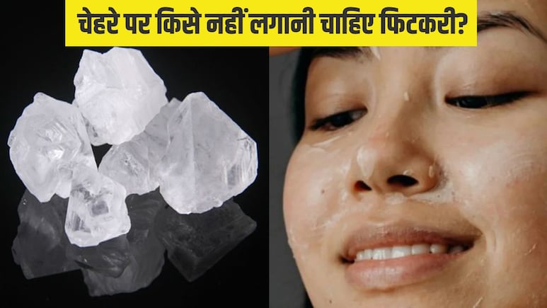 ऑयली या ड्राई, किस स्किन टाइप के लिए अच्छी होती है फिटकरी? जानें किसे चेहरे पर लगानी चाहिए और किसे नहीं ऑयली या ड्राई, किस स्किन टाइप के लिए अच्छी होती है फिटकरी? जानें किसे चेहरे पर लगानी चाहिए और किसे नहीं