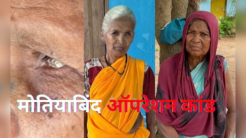 Cataract Operation Scandal : अंधेरे में डूबी जिंदगी, न रोशनी लौटी न मिला मुआवजा, झकझोर देगी इनकी कहानी 