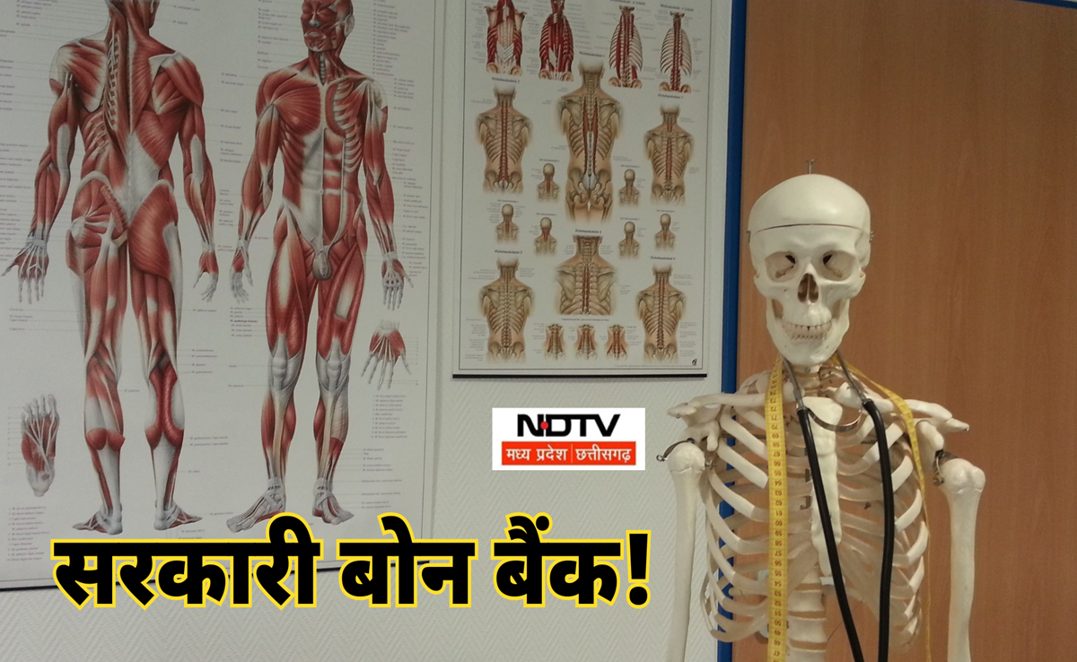 Bone Bank: जबलपुर में खुलेगा MP का पहला सरकारी बोन बैंक; इन मरीजों को होगा फायदा, एक्सपर्ट ने ये कहा