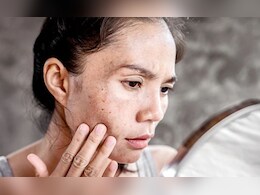 इस विटामिन की कमी से चेहरे पर होते हैं काले धब्बे, इन घरेलू नुस्खों से लौटेगी आपकी मुस्कान इस विटामिन की कमी से चेहरे पर होते हैं काले धब्बे, इन घरेलू नुस्खों से लौटेगी आपकी मुस्कान