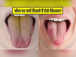 जीभ पर पीले या लाल निशान दिखें तो क्या करें? आयुर्वेदिक न्यूट्रिशनिस्ट ने बताया इन रंगों को न लें हल्के में जीभ पर पीले या लाल निशान दिखें तो क्या करें? आयुर्वेदिक न्यूट्रिशनिस्ट ने बताया इन रंगों को न लें हल्के में