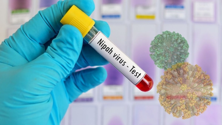 Nipah Virus Screenings At International Airports: How It Differs From Covid-19 Checks And What Travellers Should Expect