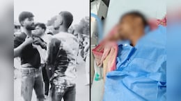Bhopal Murder Case: पार्क में हुआ था दो युवकों में विवाद और किया था चाकू से हमला, इलाज के दौरान हुई मौत