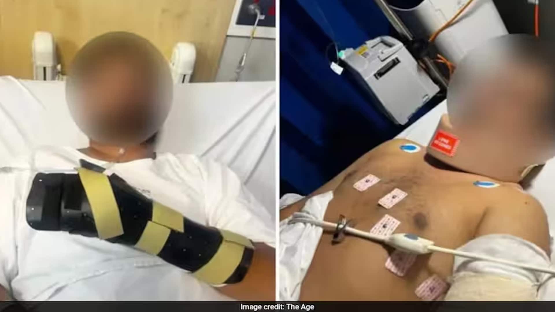"Hand Was Hanging By Thread": Indian-Origin Man Attacked In Australia