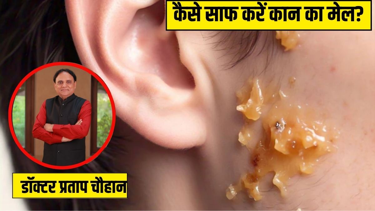 कान में जम गया है मैल? आयुर्वेदिक डॉक्टर ने बताया इस तेल की 2 बूंद डाल दें, सुबह तक सारी गंदगी आ जाएगी बाहर