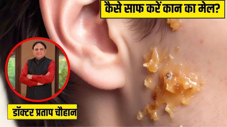 कान में जम गया है मैल? आयुर्वेदिक डॉक्टर ने बताया इस तेल की 2 बूंद डाल दें, सुबह तक सारी गंदगी आ जाएगी बाहर कान में जम गया है मैल? आयुर्वेदिक डॉक्टर ने बताया इस तेल की 2 बूंद डाल दें, सुबह तक सारी गंदगी आ जाएगी बाहर