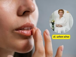 अपने होठों की देखभाल करने का सबसे अच्छा तरीका क्या है? Dr. Blossom Kochhar से जानिए बेस्ट लिप केयर टिप्स अपने होठों की देखभाल करने का सबसे अच्छा तरीका क्या है? Dr. Blossom Kochhar से जानिए बेस्ट लिप केयर टिप्स