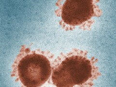 कोई वायरस नहीं, ये 'महामारी' मचाएगी दुन‍ियाभर में हाहाकार, डॉक्‍टर बोले दवा भी कारगर नहीं