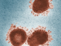 कोई वायरस नहीं, ये 'महामारी' मचाएगी दुन‍ियाभर में हाहाकार, डॉक्‍टर बोले दवा भी कारगर नहीं