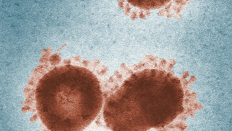 कोई वायरस नहीं, ये 'महामारी' मचाएगी दुन‍ियाभर में हाहाकार, डॉक्‍टर बोले दवा भी कारगर नहीं