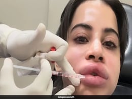 Uorfi Javed Gets Her Fillers Dissolved, Says, "I Will Get Them Again But Naturally" Uorfi Javed Gets Her Fillers Dissolved, Says, "I Will Get Them Again But Naturally"