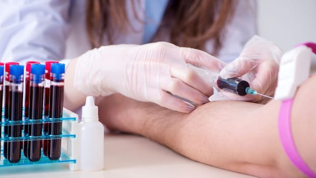 Poop Tests And Blood Tests Join Colonoscopy As Options For Colorectal Cancer Screening