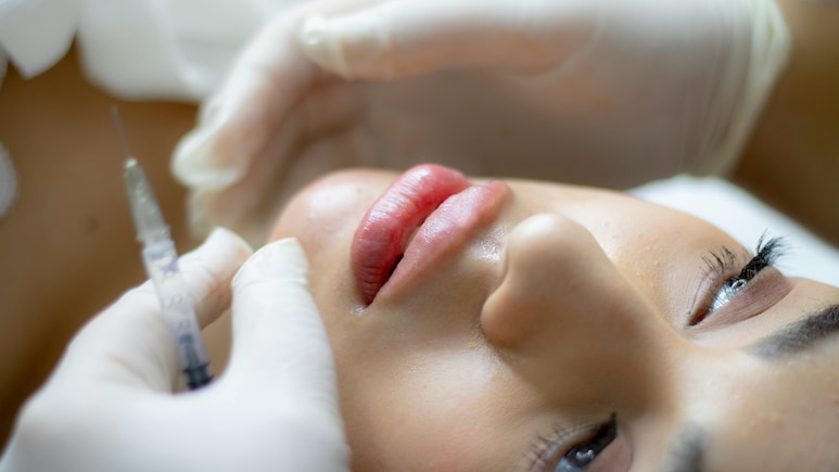 Chinese Cashier Steals Rs 20 Crore To Fund Cosmetic Surgery And Luxury Life