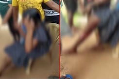 Odisha Girl, On Way To Friend's House, Set On Fire By 3 Men, Hospitalised Odisha Girl, On Way To Friend's House, Set On Fire By 3 Men, Hospitalised