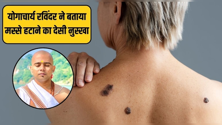 योगाचार्य रविंदर ने कहा ये 2 चीजें लगा लें मस्सों पर, 5 दिन में खुद गिर जाएगा यह योगाचार्य रविंदर ने कहा ये 2 चीजें लगा लें मस्सों पर, 5 दिन में खुद गिर जाएगा यह