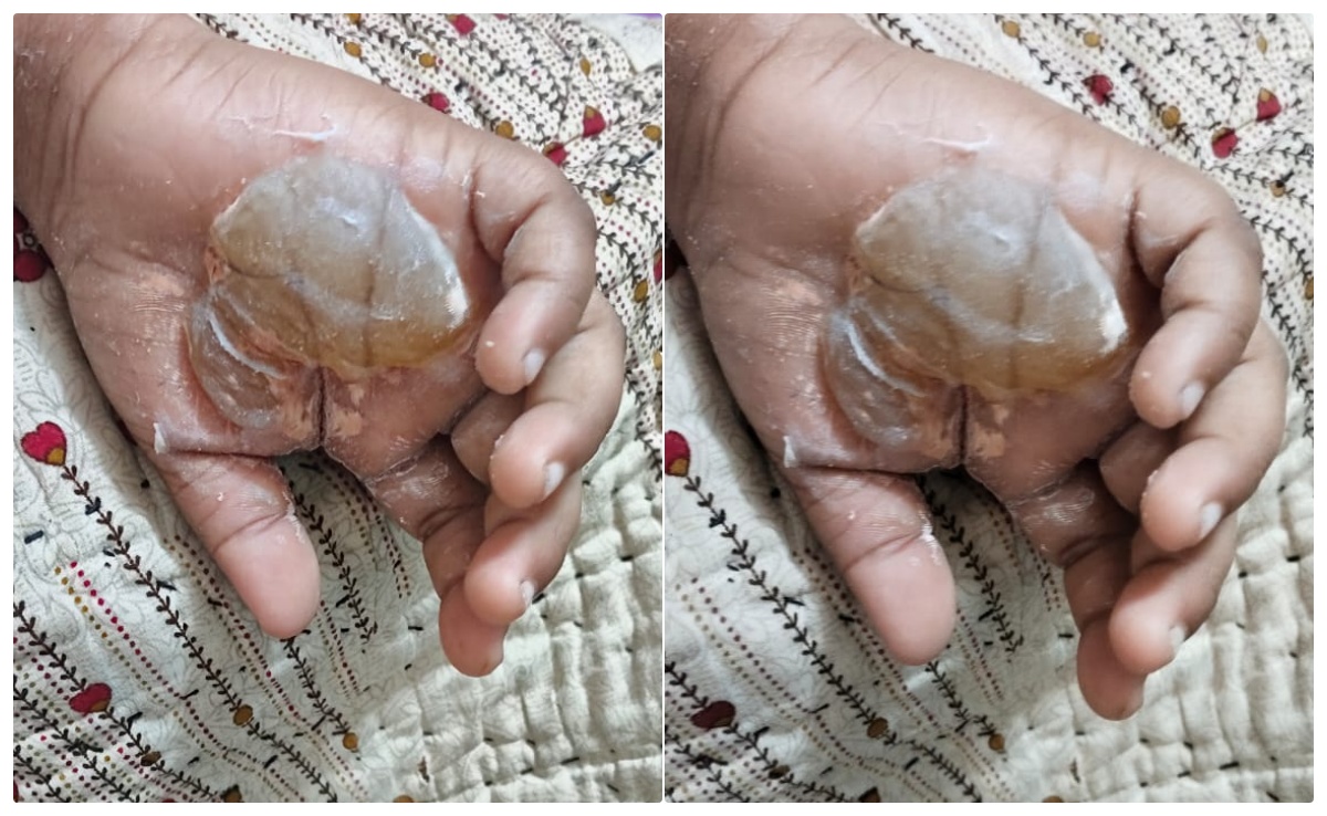ट्यूशन टीचर की शर्मनाक हरकत! राइटिंग पसंद नहीं आई तो बच्चे का हाथ जलती मोमबत्ती से जलाया