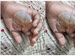 ट्यूशन टीचर की शर्मनाक हरकत! राइटिंग पसंद नहीं आई तो बच्चे का हाथ जलती मोमबत्ती से जलाया