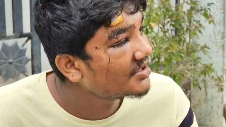 Buldhana : गाय चोरल्याचा संशय, धर्म विचारुन तरुणाला झाली मारहाण! महाराष्ट्रातील खळबळजनक घटना Buldhana : गाय चोरल्याचा संशय, धर्म विचारुन तरुणाला झाली मारहाण! महाराष्ट्रातील खळबळजनक घटना