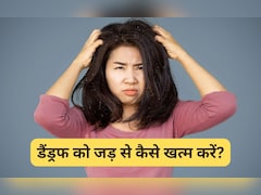 Kitchen Remedies: डैंड्रफ को जड़ से कैसे हटाएं? रूसी खत्म करने के 10 आसान और असरदार घरेलू उपाय | Dandruff Ke Gharelu Upay Recipe