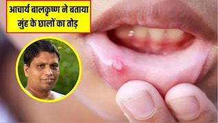Acharya Balkrishna ने बताया मुंह के छाले ठीक करने का असरदार नुस्खा, इस एक पत्ते से नेचुरली दूर हो जाएगी दिक्कत