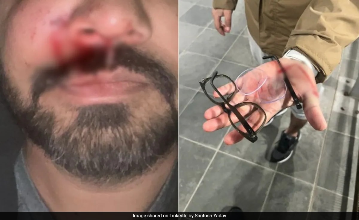 Indian-Origin Man's Face Fractured In