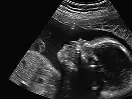 Rajasthan: झुंझुनू में भ्रूण लिंग जांच गिरोह का भंडाफोड़, हरियाणा-राजस्थान सीमा से हो रहा था गोरखधंधा